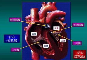主动脉瓣关闭不全如何饮食